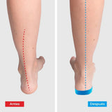 2x Pares Plantillas ComfyFeet™️- Disfruta de días sin dolor, sin tratamientos caros